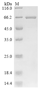 重组蛋白 Lordsdale virus Capsid Pr