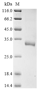 Human HPRT1 Protein蛋白，orb14773