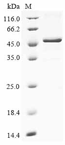 重组蛋白 Human Kelch domain-contai