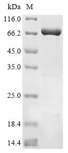 重组蛋白 Human Tyrosine-protein ph
