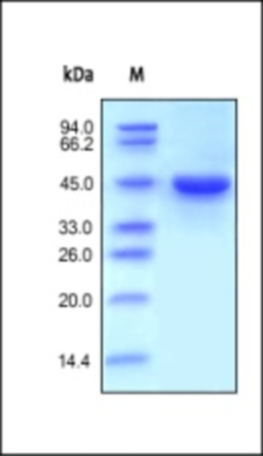 RENIN 重组蛋白，orb1227901，biorbyt