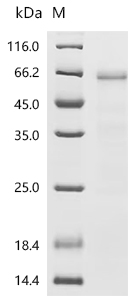 重组蛋白 Human Ubiquitin-like modi