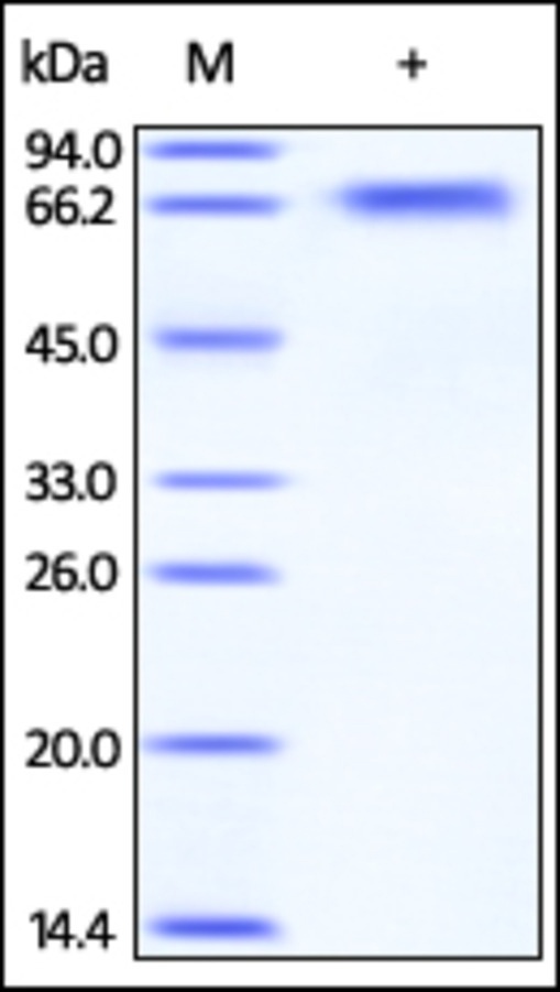 BACE1 重组蛋白，orb1228177，biorbyt