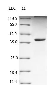 Yeast PVRL4 Protein蛋白，orb24617