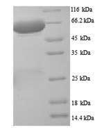Rat Plbd2 Protein蛋白，orb358316，