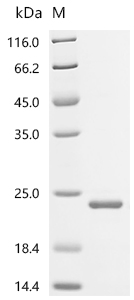 重组蛋白 Human Bromodomain-contain
