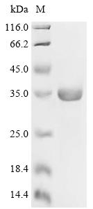 重组蛋白 Epstein-Barr virus Protei