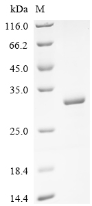 重组蛋白 Human E3 ubiquitin-protei