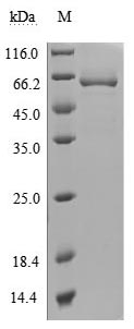 重组蛋白 Human 5'-nucleotidase (NT