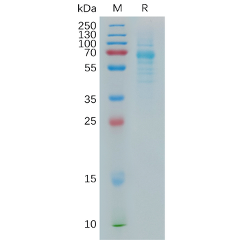 Human TIGIT Protein蛋白, His Tag