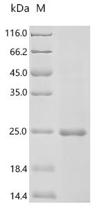 重组蛋白 Human Platelet-derived gr