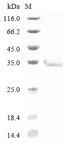 Mouse Rtn3 Protein蛋白，orb147732