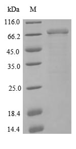 Human NCAM1 Protein蛋白，orb60426