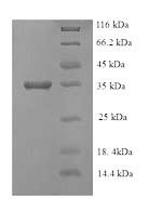 E. coli eutC Protein蛋白，orb6046