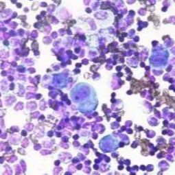 瑞士吉姆萨染色