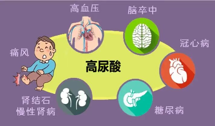 吃货的“代价”：我们如何用腺嘌呤和氧嗪酸钾“喂”出高尿酸血症