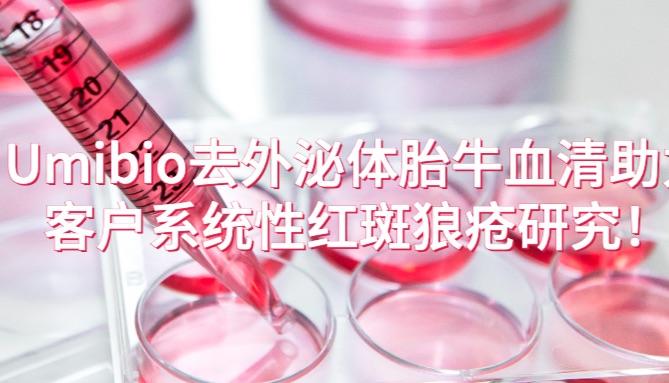 IF=9.6 | Umibio去外泌体胎牛血清助力客户系统性红斑狼疮研究！