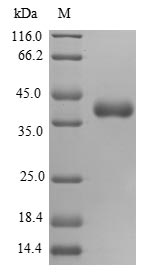Human MRPS16 Protein蛋白，orb5453
