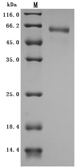 重组蛋白 Human Cytokine receptor c