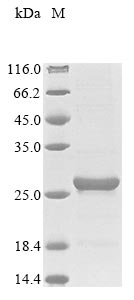 lpqE Protein蛋白，orb704625，biorb