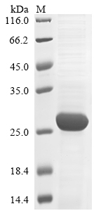 Human RBL2 Protein蛋白，orb604878