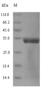 Bacterial dnaK Protein蛋白，orb38