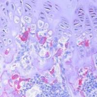 ALP 碱性磷酸酶染色