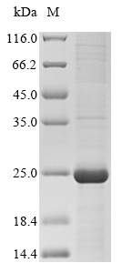 Human CYP2C9 Protein蛋白，orb6040