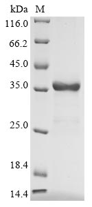 重组蛋白 Human Uteroglobin (SCGB1A