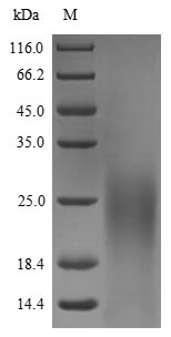 yscF Protein蛋白，orb704610，biorb