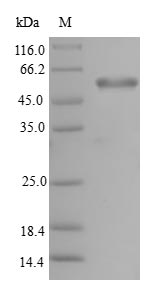 Human PHF11 Protein蛋白，orb54491