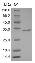 Human ARID1A Protein蛋白，orb5949