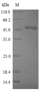 Human CBS Protein蛋白，orb605298，