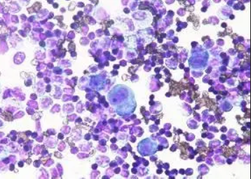 瑞士吉姆萨染色