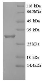 Human HLA-DRB1 Protein蛋白,orb70