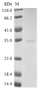 Virus M Protein蛋白，orb605454，bi