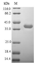 Human CHRNA3 Protein蛋白，orb5458