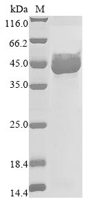 Paeniclostridium sordellii Sia