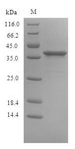 Human SIRPB1 Protein蛋白,orb3831