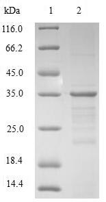 Human HMGN2 Protein蛋白，orb54253