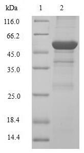 Human CCND2 Protein蛋白，orb54241