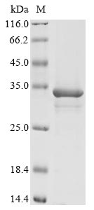 重组蛋白 Mouse Methyltransferase-l