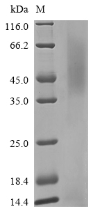 Human CHRNA3 Protein蛋白,orb6053