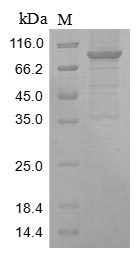 Human ENO1 Protein蛋白，orb594974