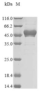 重组蛋白 Human Splicing factor 3B 