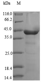 Human DYNC2LI1 Protein蛋白，orb41
