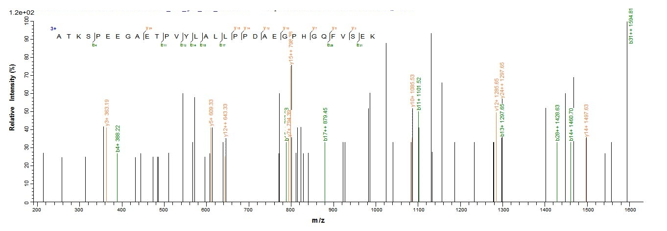 Human CBR1 Protein蛋白,orb603957