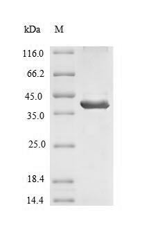 Human SIRPB1 Protein蛋白，orb3830