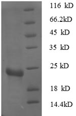 重组蛋白 Escherichia coli 30S ribo
