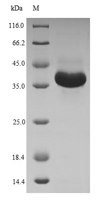 Human MBTPS1 Protein蛋白，orb3831